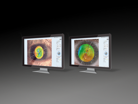 バイオメトリー